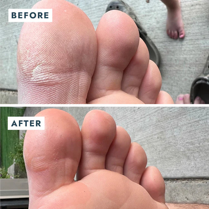 Voesh Solemate Heel Repair Balm