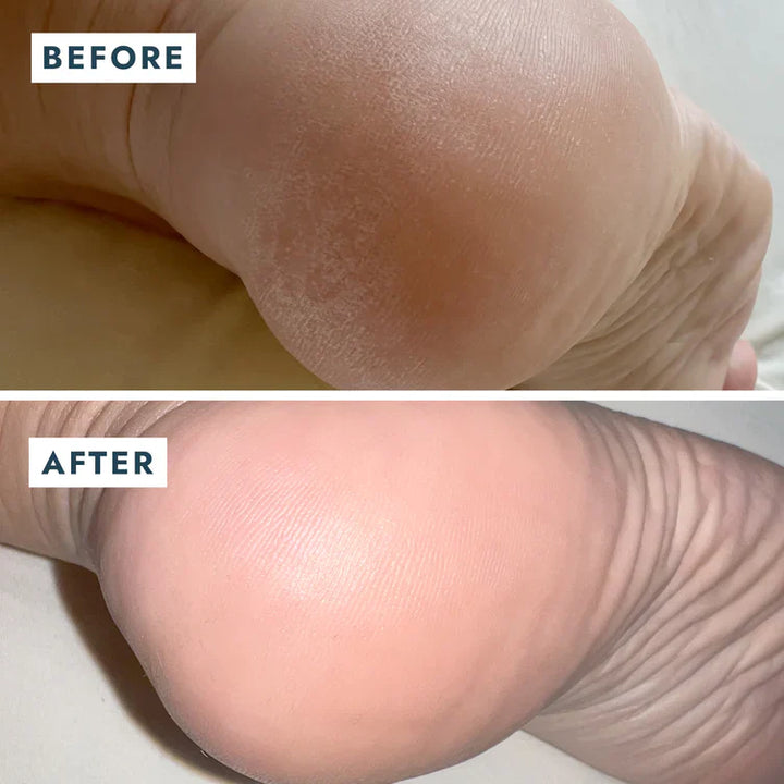 Voesh Solemate Heel Repair Balm
